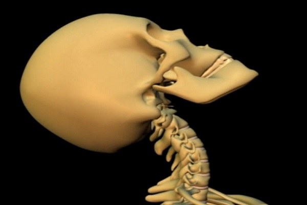 Chiropractic Treatment for Whiplash: Is It A Good Idea?